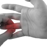 Panduan Lengkap Mengatasi Jari Tangan Kaku: Penyebab, Gejala, dan Solusinya