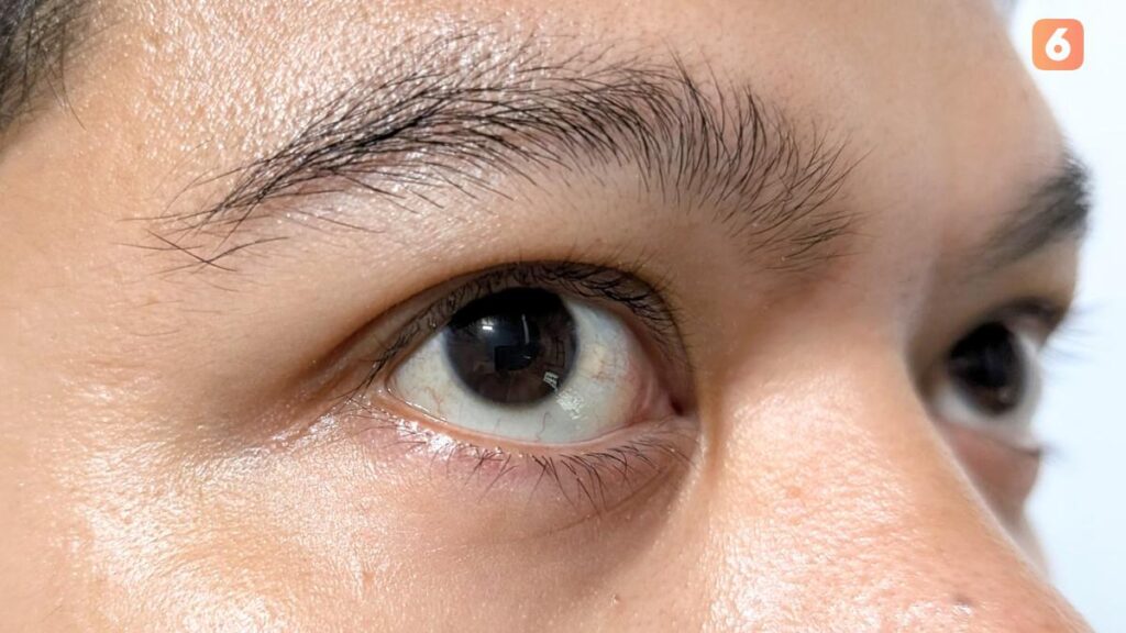 Cara Mengobati Mata Silinder, Panduan Lengkap Penanganan yang Efektif