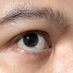 Cara Mengobati Mata Silinder, Panduan Lengkap Penanganan yang Efektif