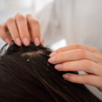 11 Tips Menghilangkan Kutu Rambut