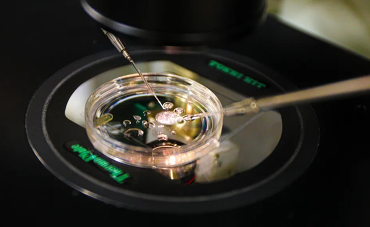 Ilmuwan AS Ciptakan Embrio Manusia dari Sel Kulit, Terobosan Dunia Reproduksi