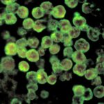 India Darurat Kasus Amoeba Pemakan Otak, Begini Cara Penyebaran dan Gejalanya