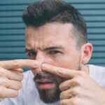 Cara Mengatasi Jerawat di Hidung agar Tidak Kembali Lagi, Begini Triknya