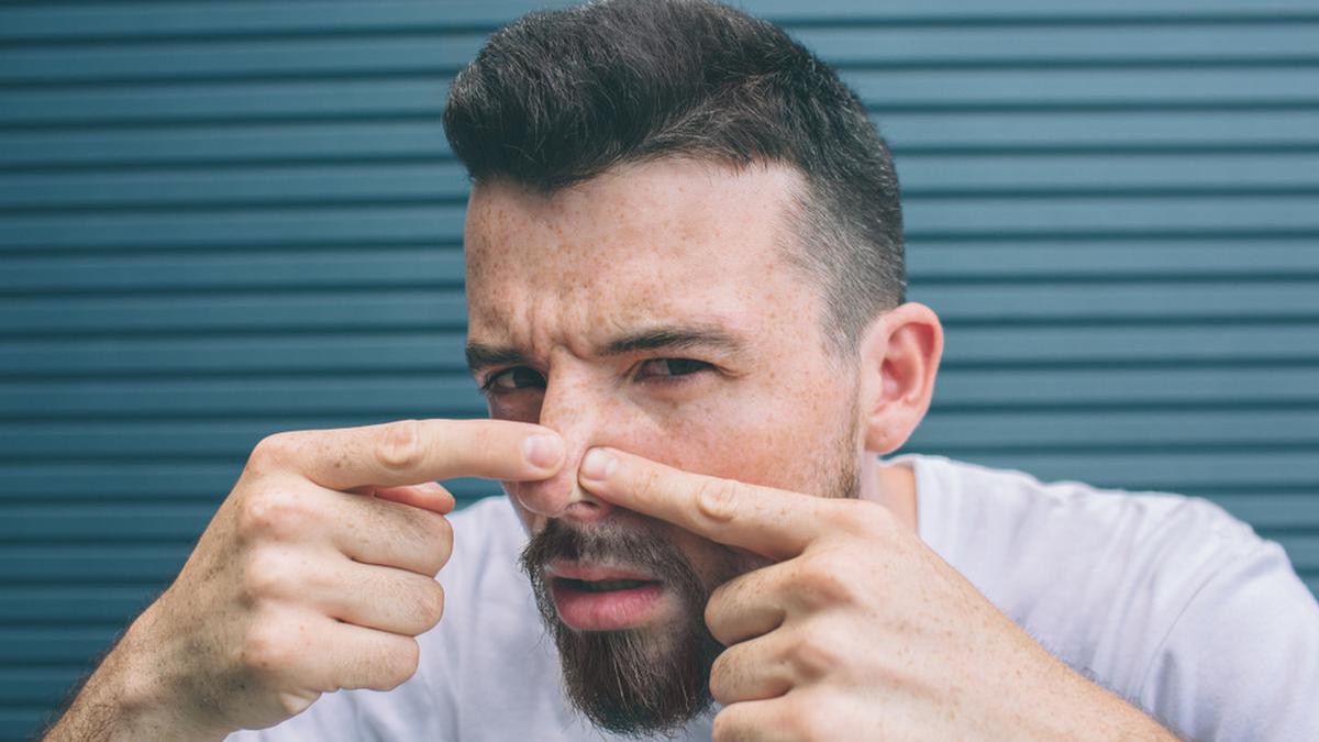 Cara Mengatasi Jerawat di Hidung agar Tidak Kembali Lagi, Begini Triknya