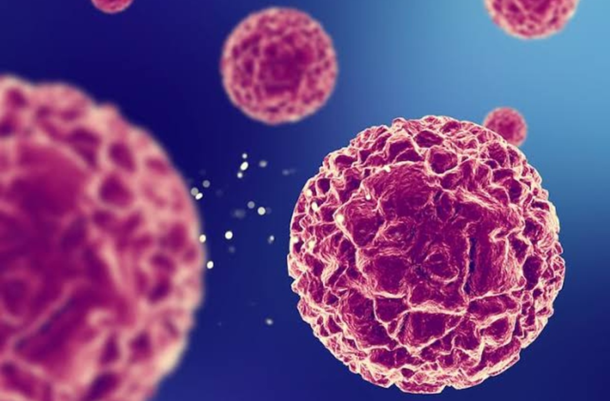 Jangan Abaikan 10 Ciri Tubuh yang Bisa Jadi Tanda Awal Kanker