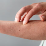 15 Tips Mengatasi Kulit Kering